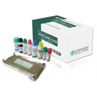 甲型肝炎病毒IgM抗体检测试剂盒（酶联免疫法）